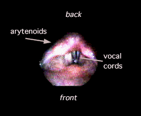 labelled vocal cords