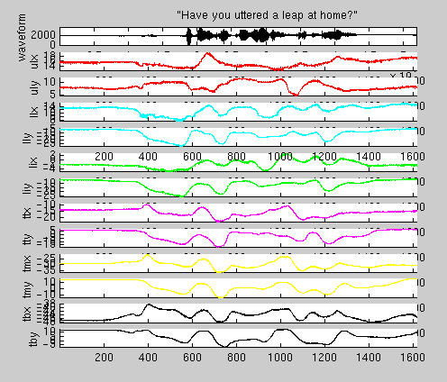 EMA coils and waveform display