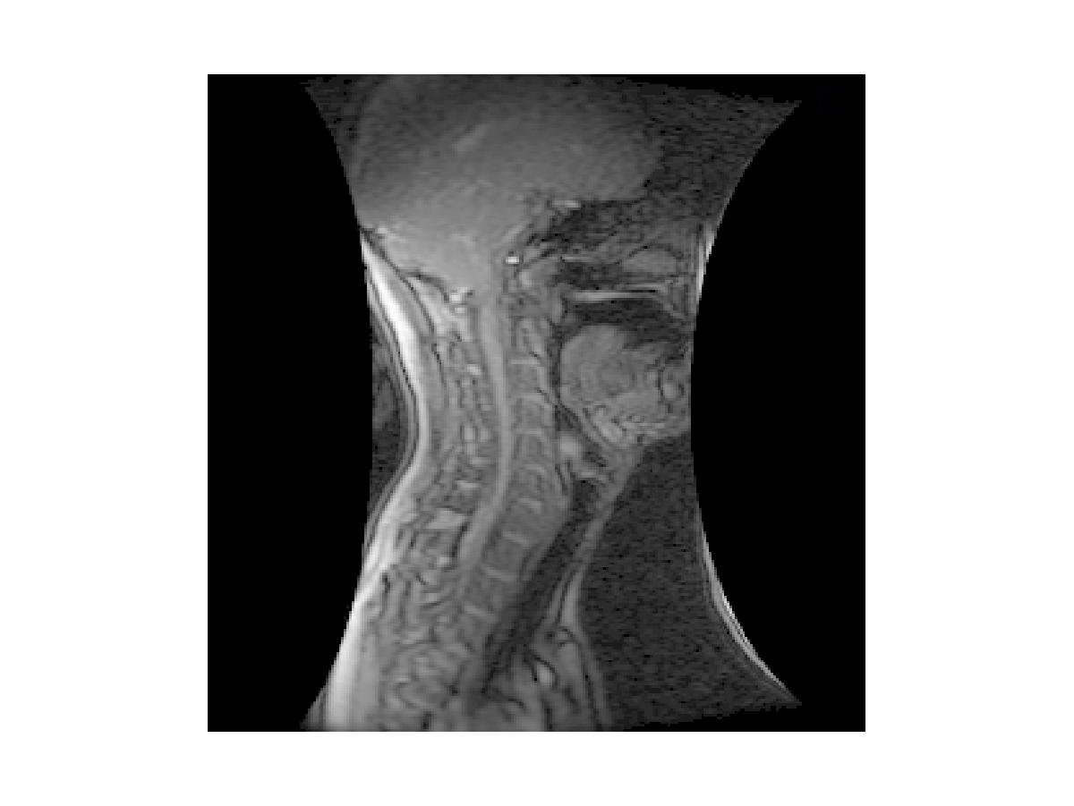 [ah] vocal tract profile