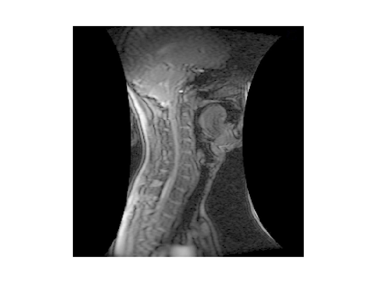 Vocal tract profile of [u:]